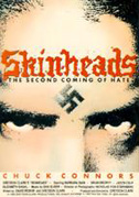 Skinheads