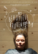 My beautiful broken brain