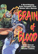 Brain of blood