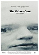 The Oxbow cure