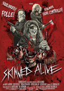Skinned alive