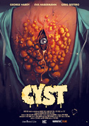 Cyst: La ciste assassina